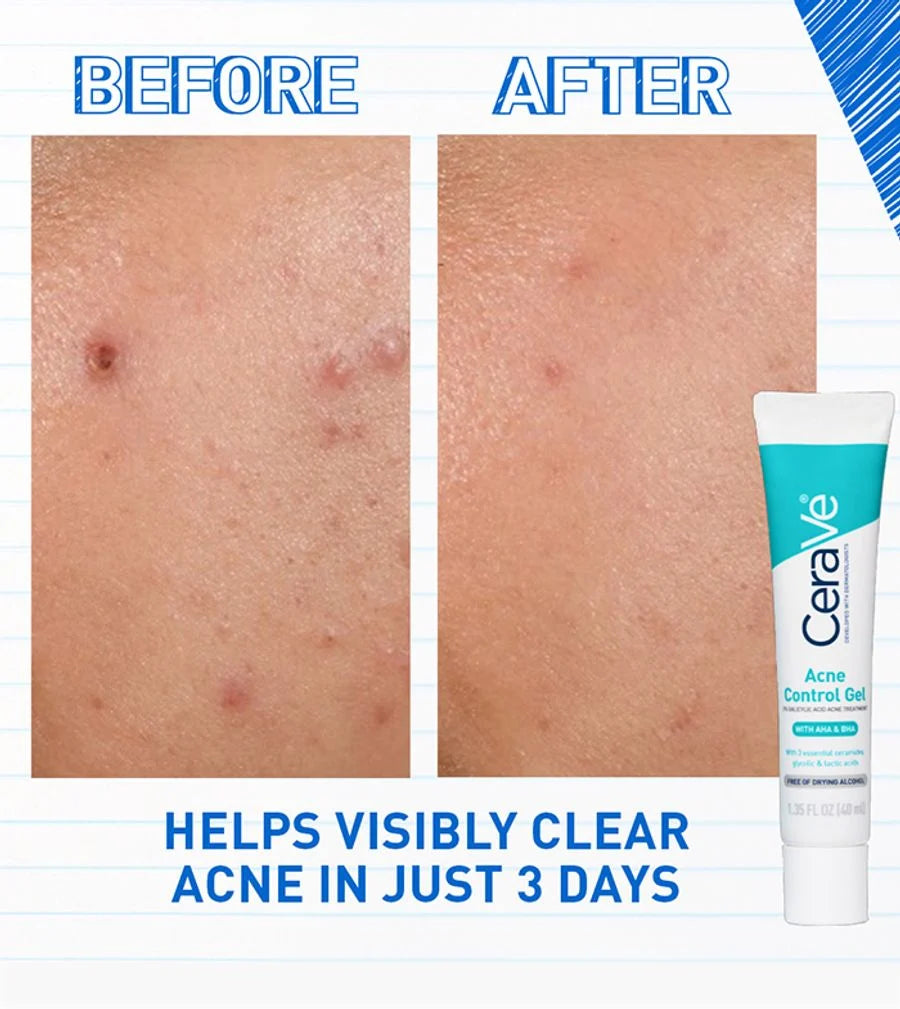 Cerave Blemish Control Gel 40ml