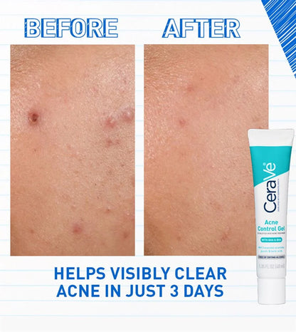 Cerave Blemish Control Gel 40ml